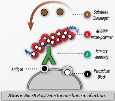 PolyDetector IHC â€” Sistema de DetecciÃ³n por MicropolÃ­mero Fab