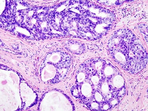Anticuerpo Receptor de EstrÃ³genos (ER) â€” SP1